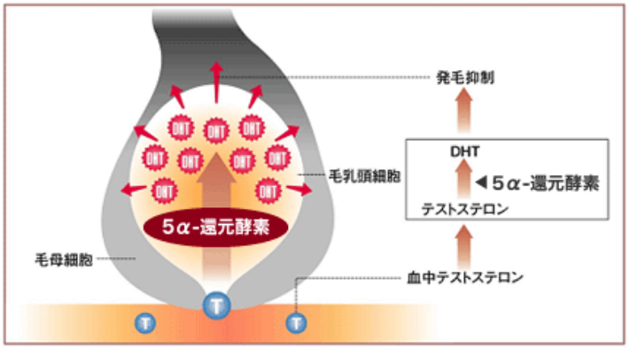 AGAの仕組み（DHT図解）
